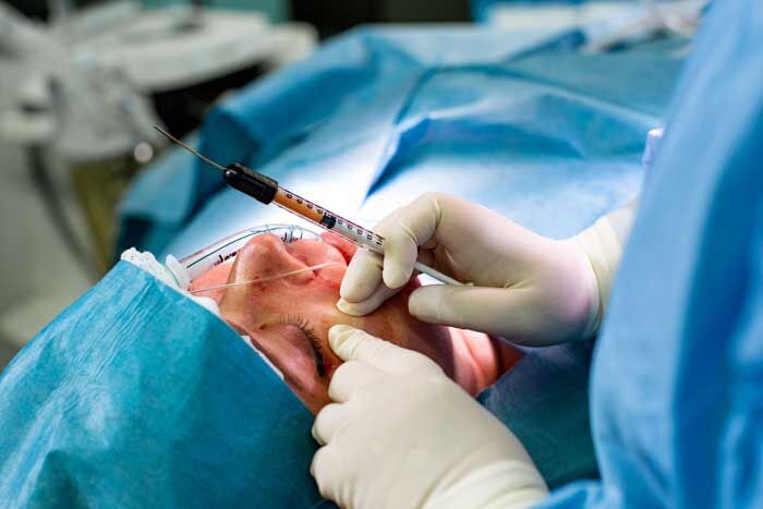 نحوه استفاده از چربی خود در جراحی تزریق چربی: راهکارها و نکات