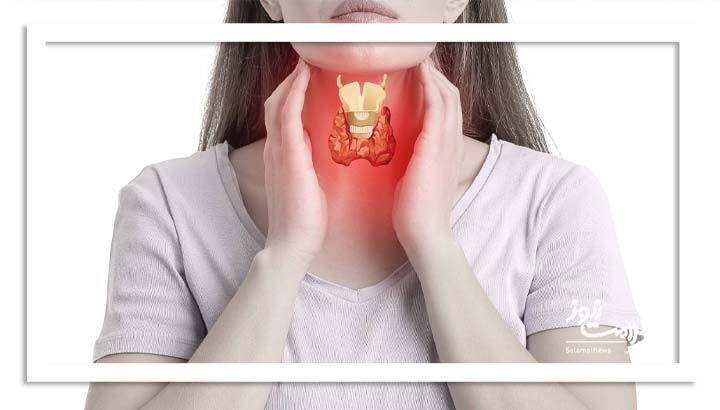 طوفان تیروئیدی چیست و چه علائمی دارد؟ طوفان تیروئیدی چیست و چه علائمی دارد؟