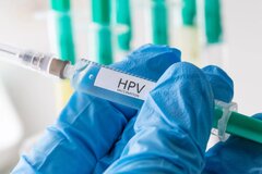 آزمایش HPV چگونه انجام می شود؟ و نحوه انجام آزمایش