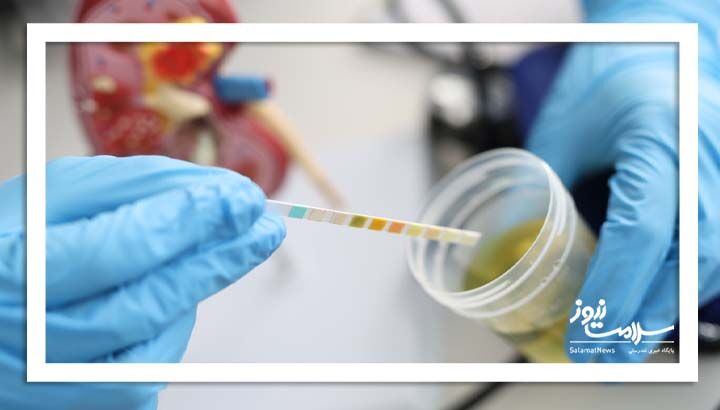 چرا در ادرارم مخاط وجود دارد؟ چرا در ادرارم مخاط وجود دارد؟