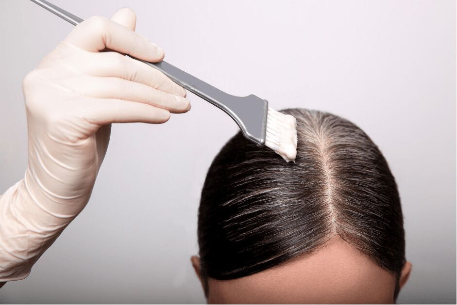 عارضههای زیاده روی در رنگ کردن مو/ کراتینه چه مضراتی دارد عارضههای زیاده روی در رنگ کردن مو/ کراتینه چه مضراتی دارد