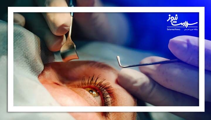 از کجا بفهمیم آب مروارید داریم؟ از کجا بفهمیم آب مروارید داریم؟