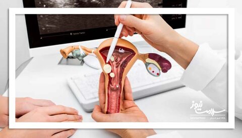 فیبروم رحمی و ارتباط آن با بیماری قلبی در زنان