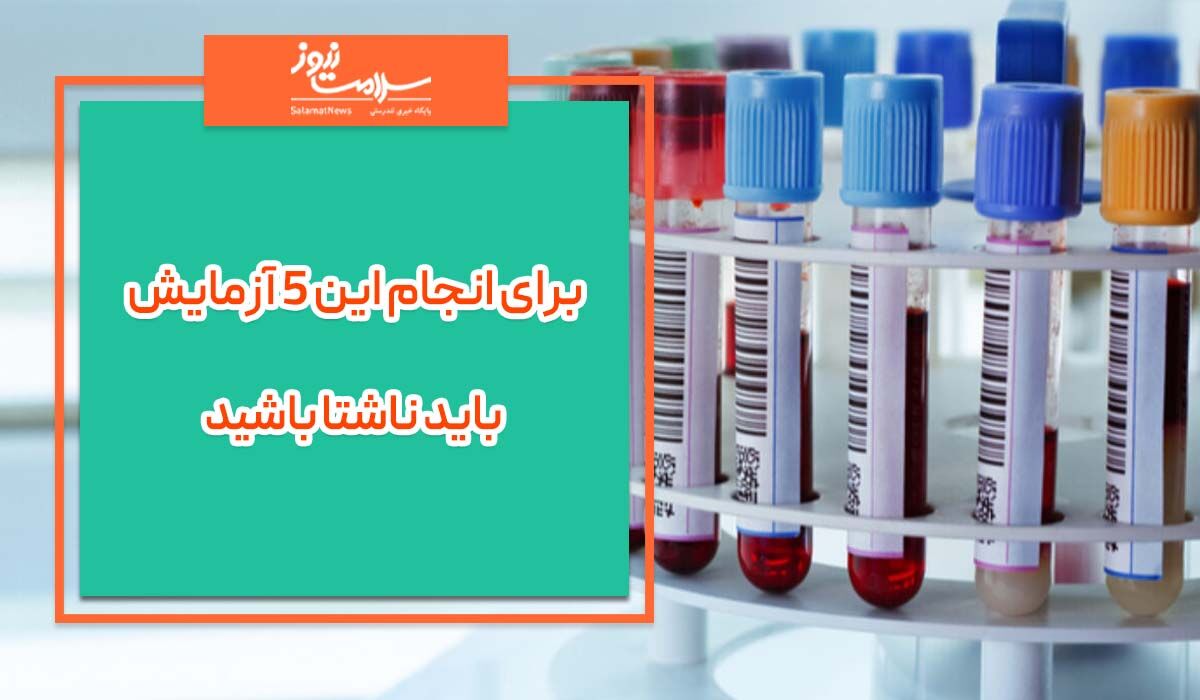 برای انجام این ۵ آزمایش باید ناشتا باشید برای انجام این ۵ آزمایش باید ناشتا باشید