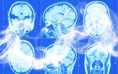 ارتباط بین مصرف سیگار و بیماری کُشنده مغزی