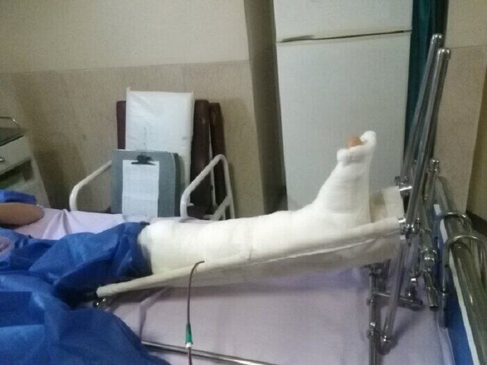 مدیر مدرسه پای یک دانش آموز را شکست؟ مدیر مدرسه پای یک دانش آموز را شکست؟