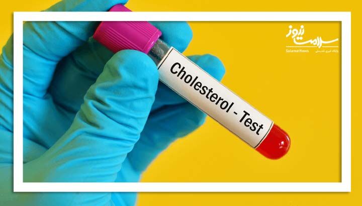 کاهش کلسترول بد خون خطر زوال عقل را کاهش میدهد کاهش کلسترول بد خون خطر زوال عقل را کاهش میدهد