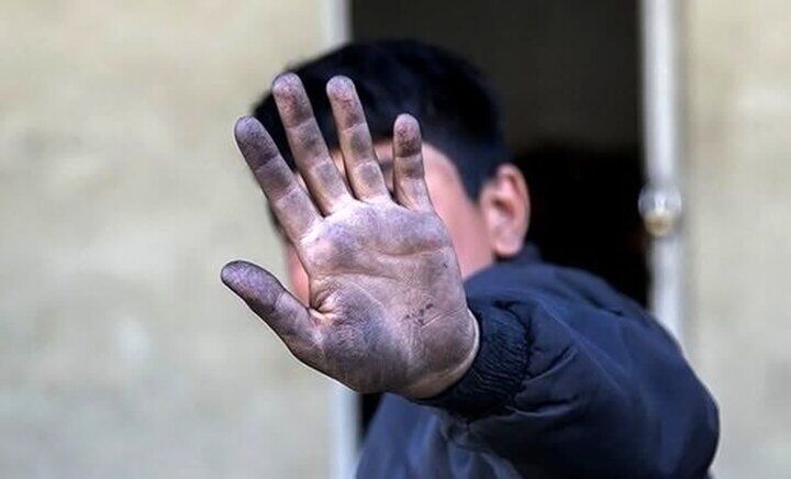 مهم ترین بیماری های کودکان کار/ از کمردرد تا مشکلات پوستی مهم ترین بیماری های کودکان کار/ از کمردرد تا مشکلات پوستی