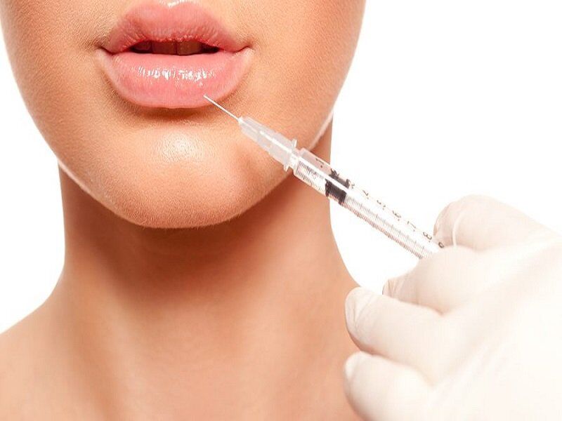 نکاتی مهم که باعث ماندگاری تزریق ژل صورت میشود نکاتی مهم که باعث ماندگاری تزریق ژل صورت میشود