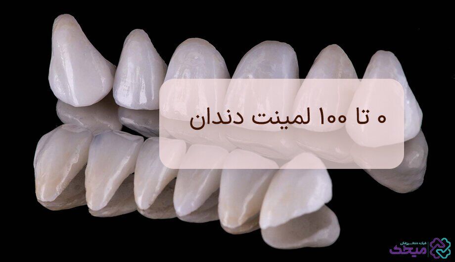 همه چیز در مورد لمینت دندان