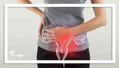 ۴ مکمل پیشنهادی متخصصان برای کنترل علائم PCOS