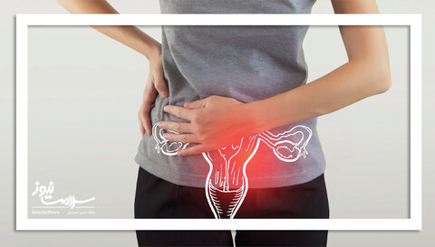 ۴ مکمل پیشنهادی متخصصان برای کنترل علائم PCOS