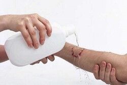 افزایش آمار گازگرفتگی توسط حیوانات خانگی/ ۱۶ مرگ ناشی از هاری در ۱۴۰۲ افزایش آمار گازگرفتگی توسط حیوانات خانگی/ ۱۶ مرگ ناشی از هاری در ۱۴۰۲