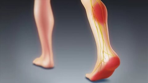 دلیل دردهای لگنی و تیر کشیدن ساق پا را بشناسید