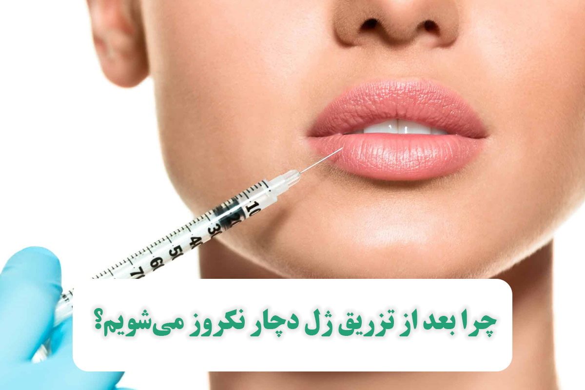 چرا بعد از تزریق ژل دچار نکروز میشویم؟ چرا بعد از تزریق ژل دچار نکروز میشویم؟