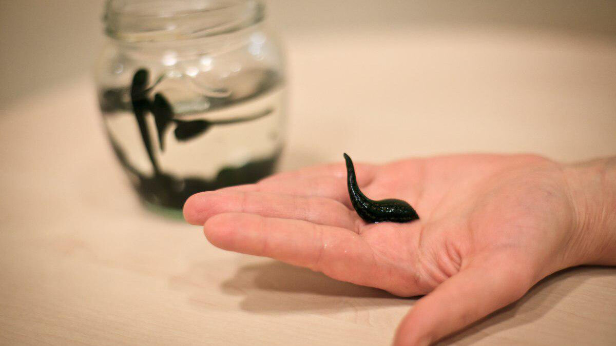 در زالودرمانی فقط زالوی طبی عرضه شده در داروخانهها مورد تائید است در زالودرمانی فقط زالوی طبی عرضه شده در داروخانهها مورد تائید است