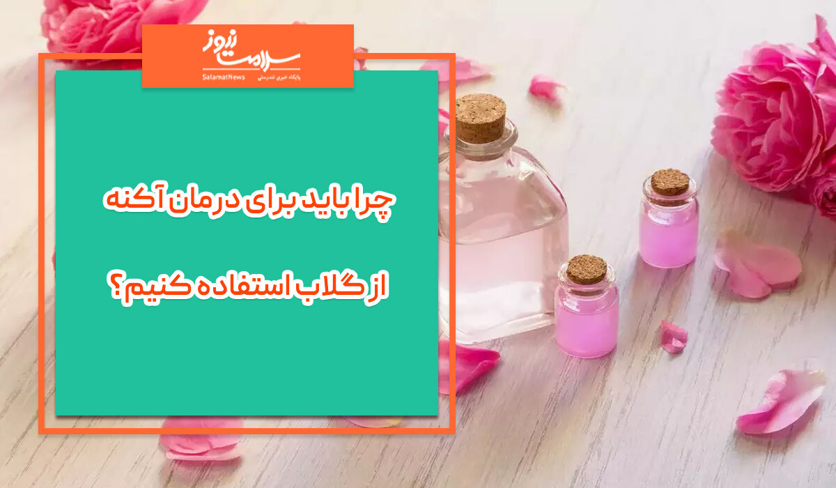 برای درمان آکنه از گلاب استفاده کنید برای درمان آکنه از گلاب استفاده کنید