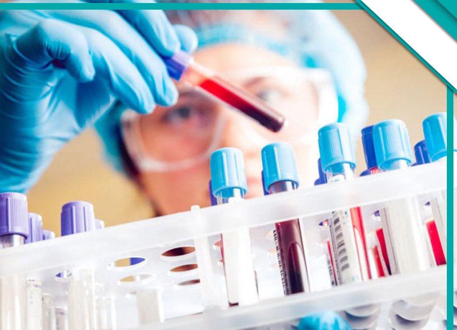 چگونگی انجام آزمایش در منزل