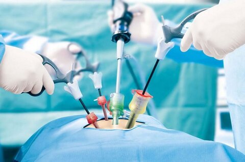 جراحی سنگ کلیه بیشترین جراحی در حوزه اورولوژی است
