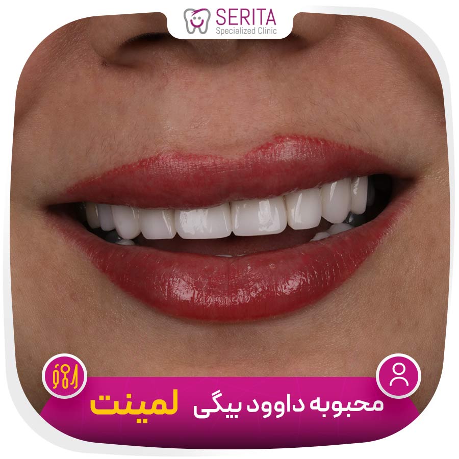 معرفی کلینیک سریتا: دندان پزشکی اقساطی در شرق تهران