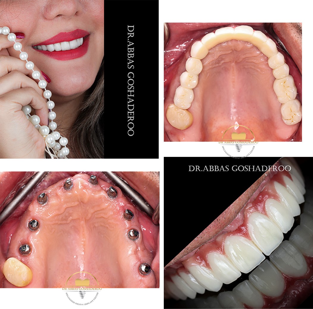 دندانپزشک خوب در زعفرانیه : دکتر گشاده رو