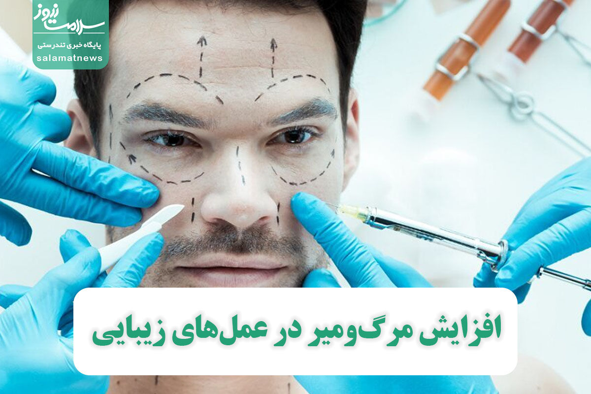 افزایش مرگومیر در عملهای زیبایی افزایش مرگومیر در عملهای زیبایی