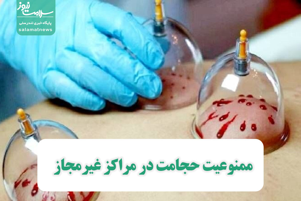 ممنوعیت حجامت در مراکز غیرمجاز ممنوعیت حجامت در مراکز غیرمجاز