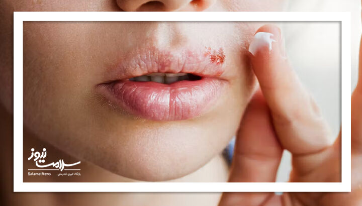 چرا در لبم احساس عجیبی دارم؟ چرا در لبم احساس عجیبی دارم؟