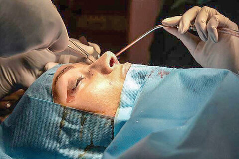 سرفصلی با عنوان جراحی‌های زیبایی در برنامه آموزشی پزشکی عمومی وجود ندارد