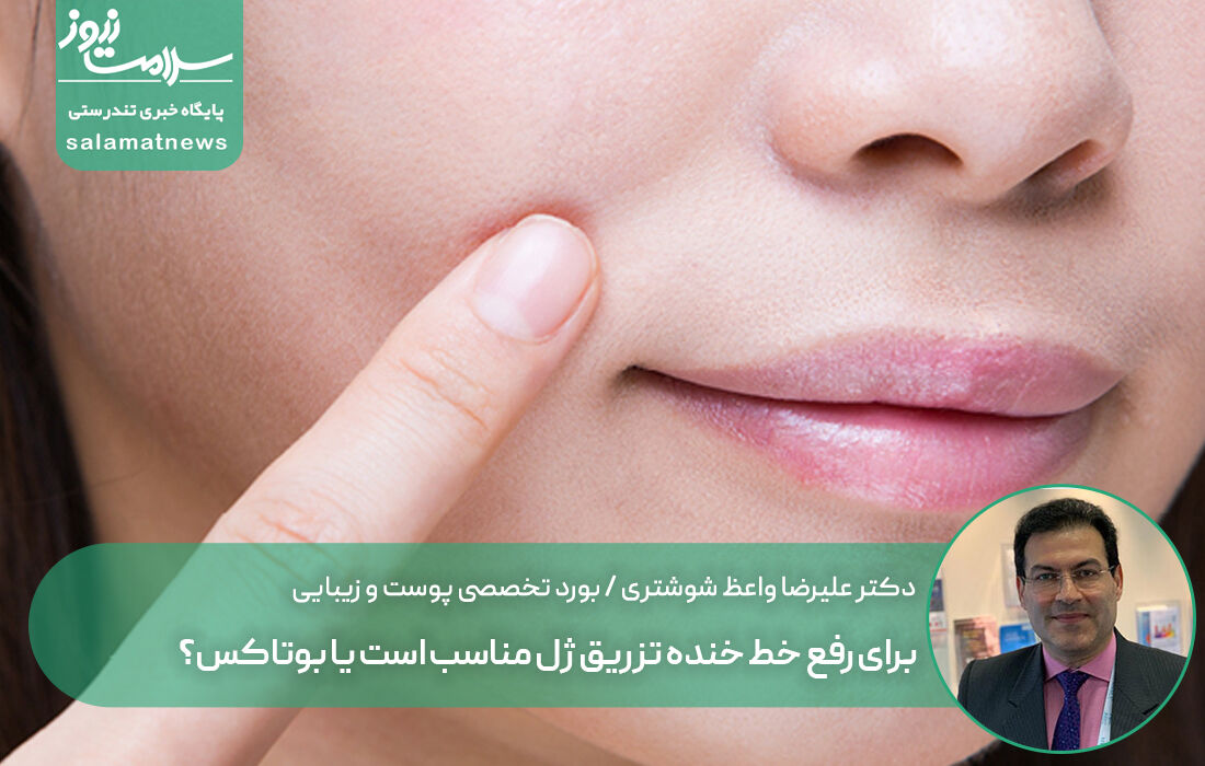 برای رفع خط خنده تزریق ژل مناسب است یا بوتاکس؟ برای رفع خط خنده تزریق ژل مناسب است یا بوتاکس؟