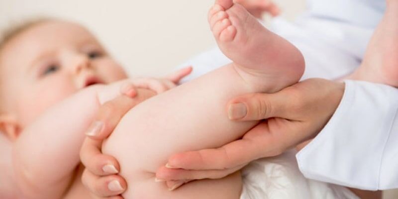بیماری های مادرزادی شایع و نادر ارتوپدی اطفال