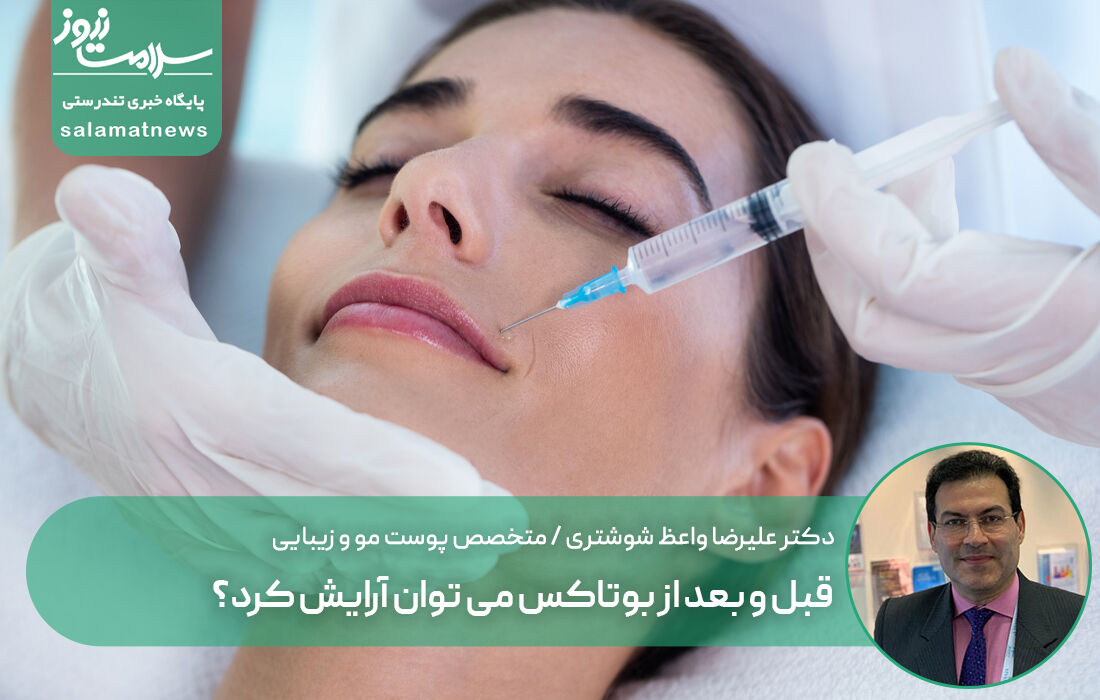 قبل و بعد از بوتاکس می توان آرایش کرد؟ قبل و بعد از بوتاکس می توان آرایش کرد؟