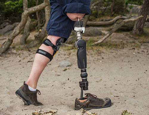 کاشت پای مصنوعی