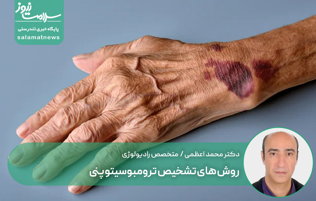 روش های تشخیص ترومبوسیتوپنی روش های تشخیص ترومبوسیتوپنی