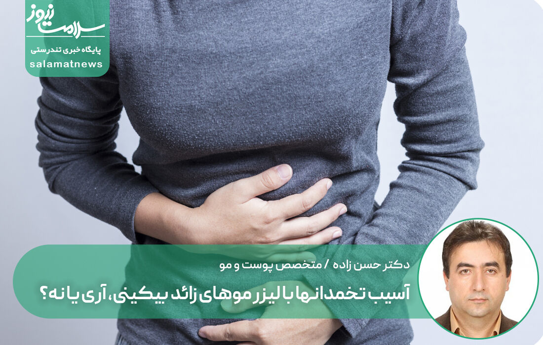 آسیب تخمدانها با لیزر موهای زائد، آری یا نه؟ آسیب تخمدانها با لیزر موهای زائد، آری یا نه؟
