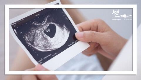 آیا سن محدودیتی برای بارداری زنان ایجاد می‌کند؟