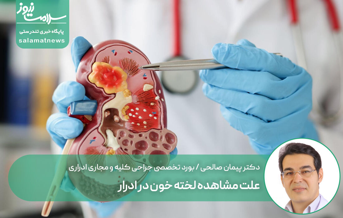 علت مشاهده لخته خون در ادرار علت مشاهده لخته خون در ادرار