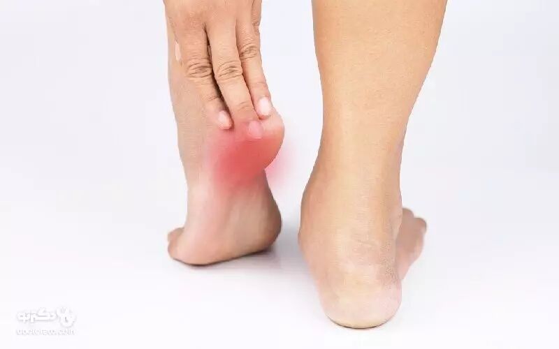 آنچه باید درباره درد پاشنه بدانیم آنچه باید درباره درد پاشنه بدانیم