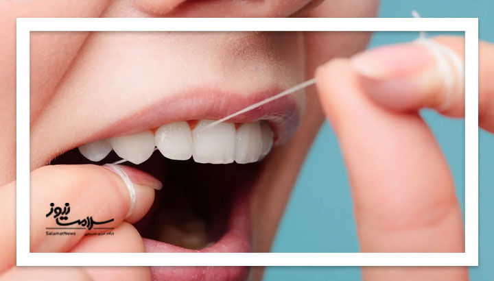 ۵ فایده نخ دندان و نحوه استفاده صحیح از آن ۵ فایده نخ دندان و نحوه استفاده صحیح از آن