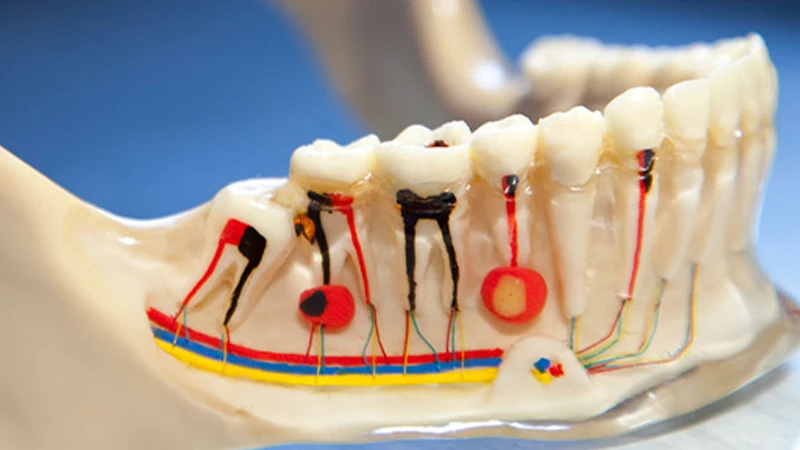 عمر دندان عصب کشی شده چقدر است ؟ | معرفی4 روش افزایش طول عمر