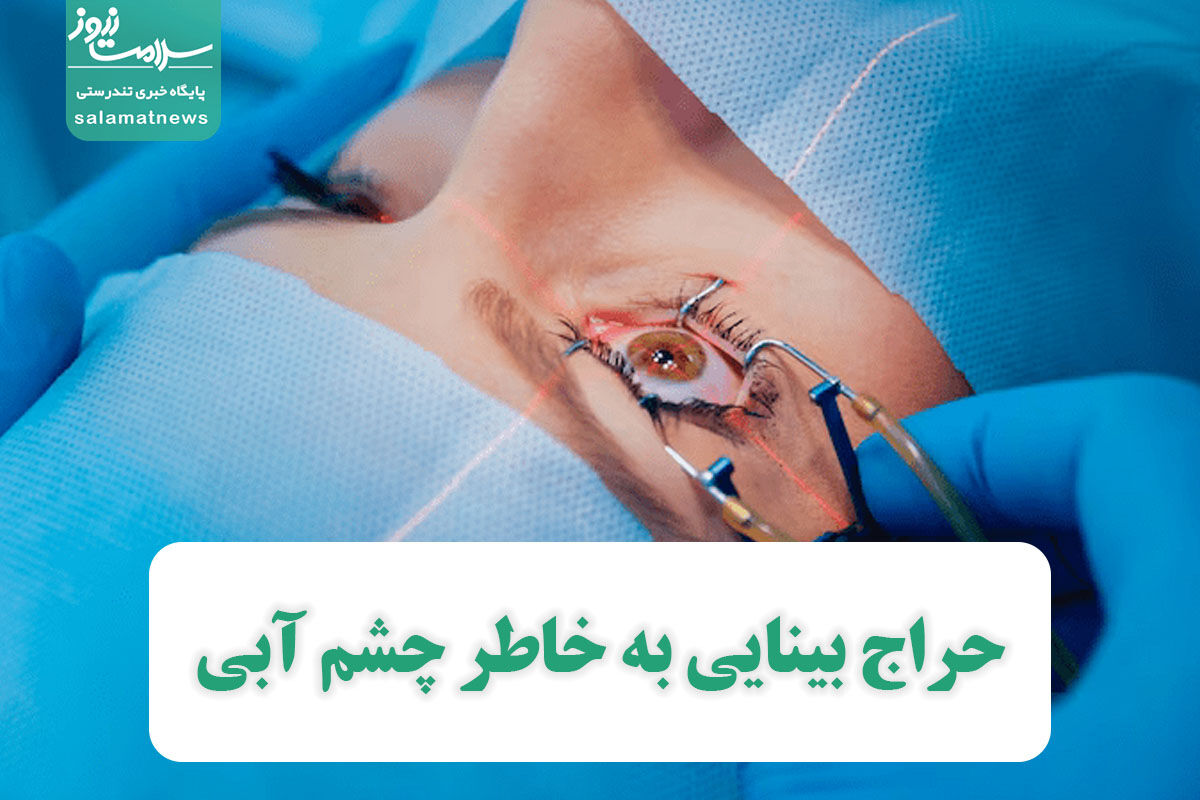 حراج بینایی به خاطر چشم آبی حراج بینایی به خاطر چشم آبی