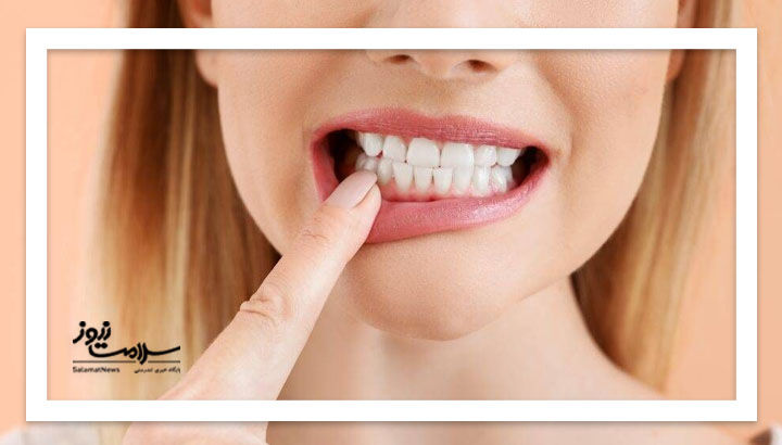 این میوه لثه را تقویت میکند این میوه لثه را تقویت میکند
