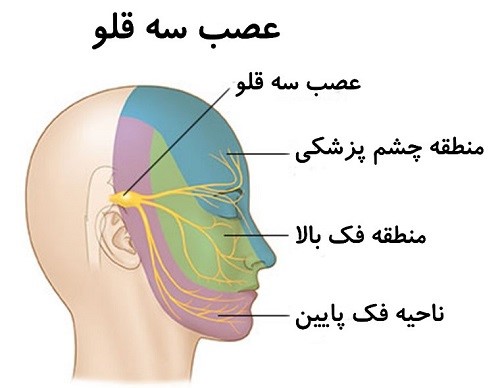 آیا دردهای عصب سه قلوی صورت قطعا برطرف می‌شوند؟