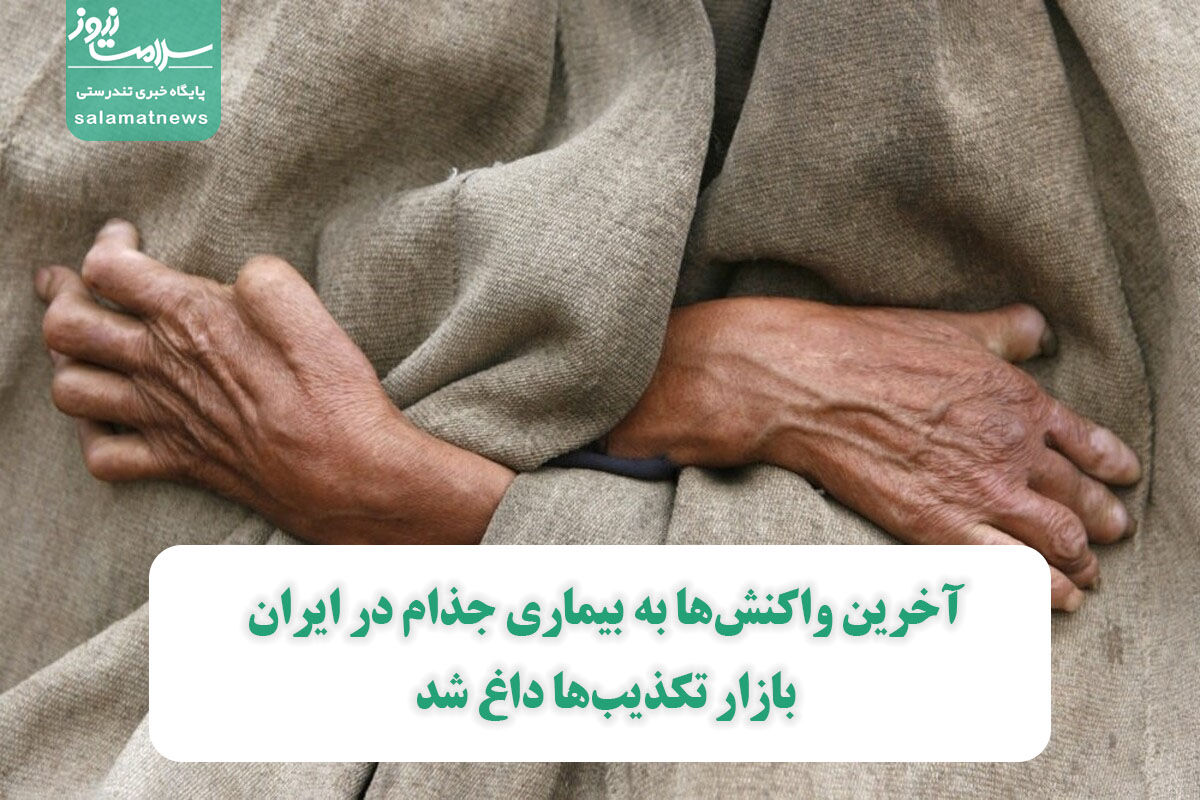 آخرین واکنشها به بیماری جذام در ایران/ بازار تکذیبها داغ شد آخرین واکنشها به بیماری جذام در ایران/ بازار تکذیبها داغ شد