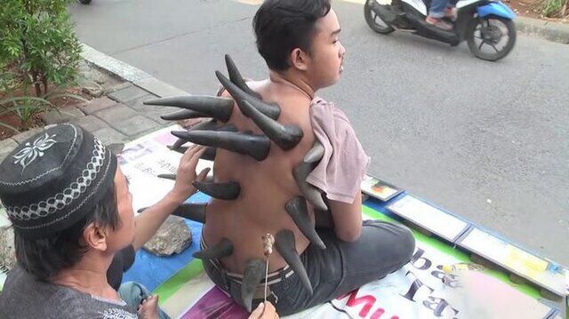 درمانهای دلهرهآور؛ از طب سوزنی زبان تا چکشکاریِ استخوانها