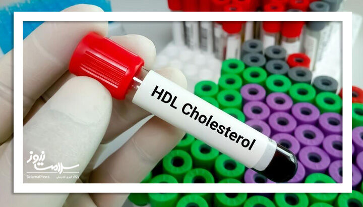 5 راه برای افزایش کلسترول خوب بدن 5 راه برای افزایش کلسترول خوب بدن