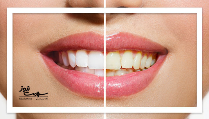 اشتباهاتی که سلامت دندانها را به خطر میاندازد اشتباهاتی که سلامت دندانها را به خطر میاندازد