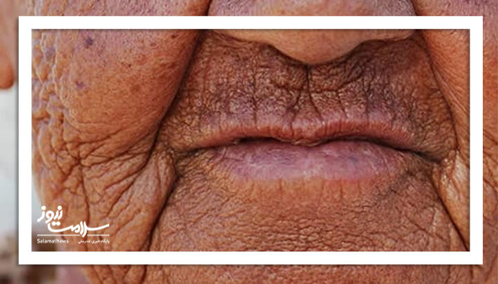 الاستوز خورشیدی