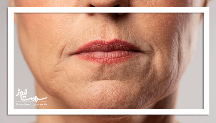 افتادگی پوست