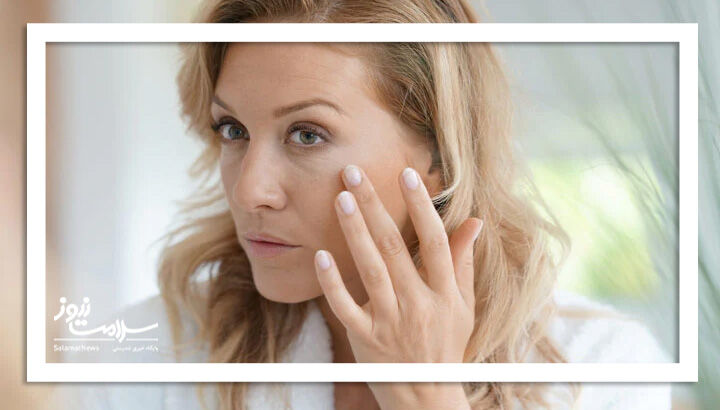 لکه های پوستی که با افزایش سن ظاهر می شوند لکه های پوستی که با افزایش سن ظاهر می شوند